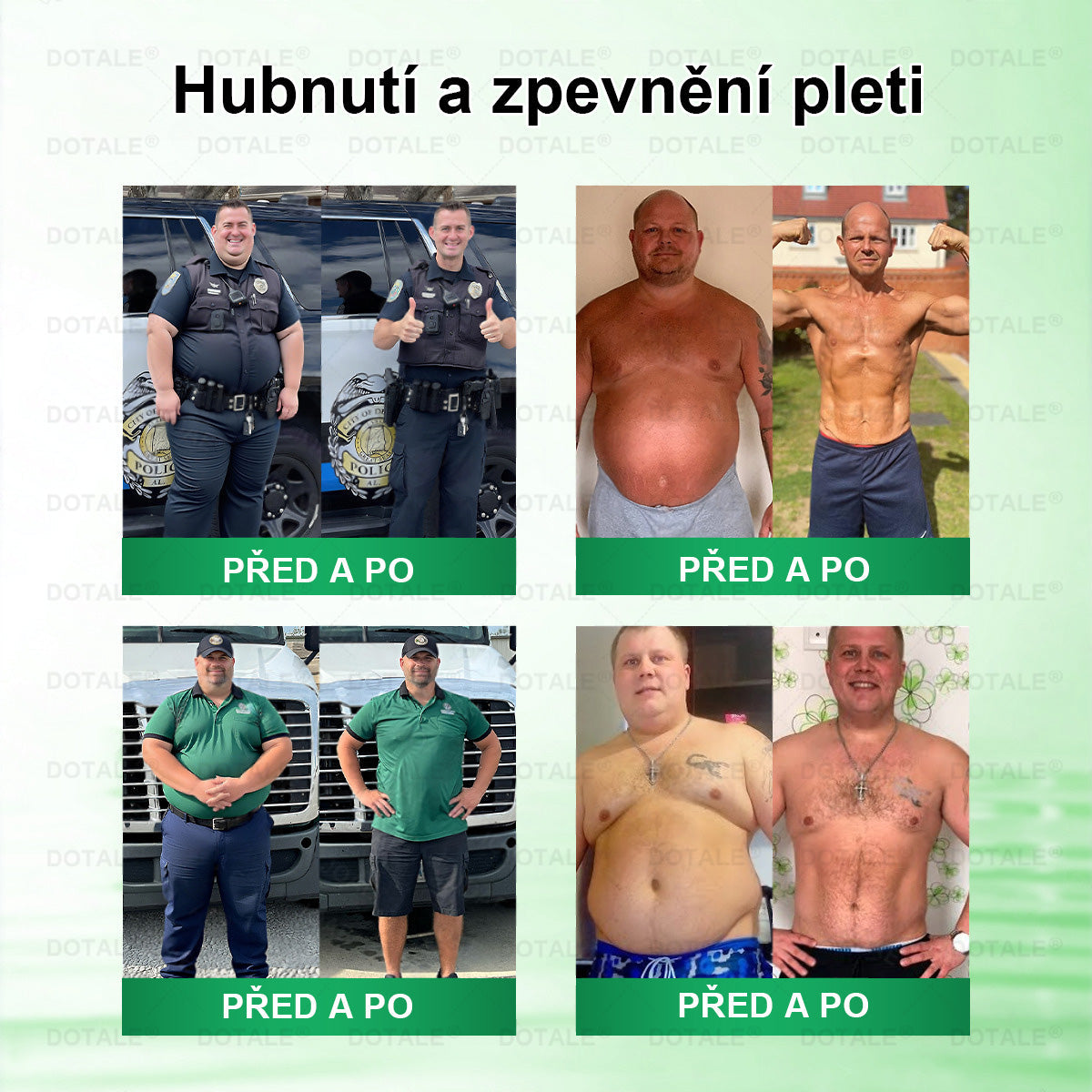 𝑫𝑶𝖳𝖠𝐋𝐄® 💥metabolická nano mikrojehličková náplast  (Pouze jednou denně, viditelné výsledky již do 7 dnů!) ✅ Formule Berberin + Moringa, ideální při nadváze, nedokonalostech pokožky, diabetu, spánkové apnoe a kloubních potížích 💥💥