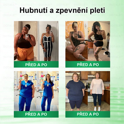 𝑫𝑶𝖳𝖠𝐋𝐄® 💥metabolická nano mikrojehličková náplast  (Pouze jednou denně, viditelné výsledky již do 7 dnů!) ✅ Formule Berberin + Moringa, ideální při nadváze, nedokonalostech pokožky, diabetu, spánkové apnoe a kloubních potížích 💥💥